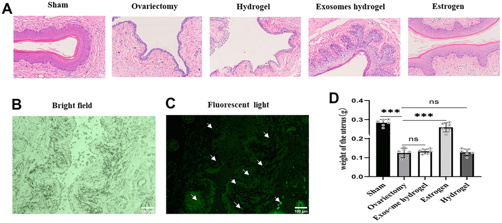 Vaginal sections and HE staining. (A) Vaginal epithelial morphology among different groups after HE staining; (B, C) Distribution of DIR-labeled exosomes in vaginal tissue; (D) Uterine weights in each group.
