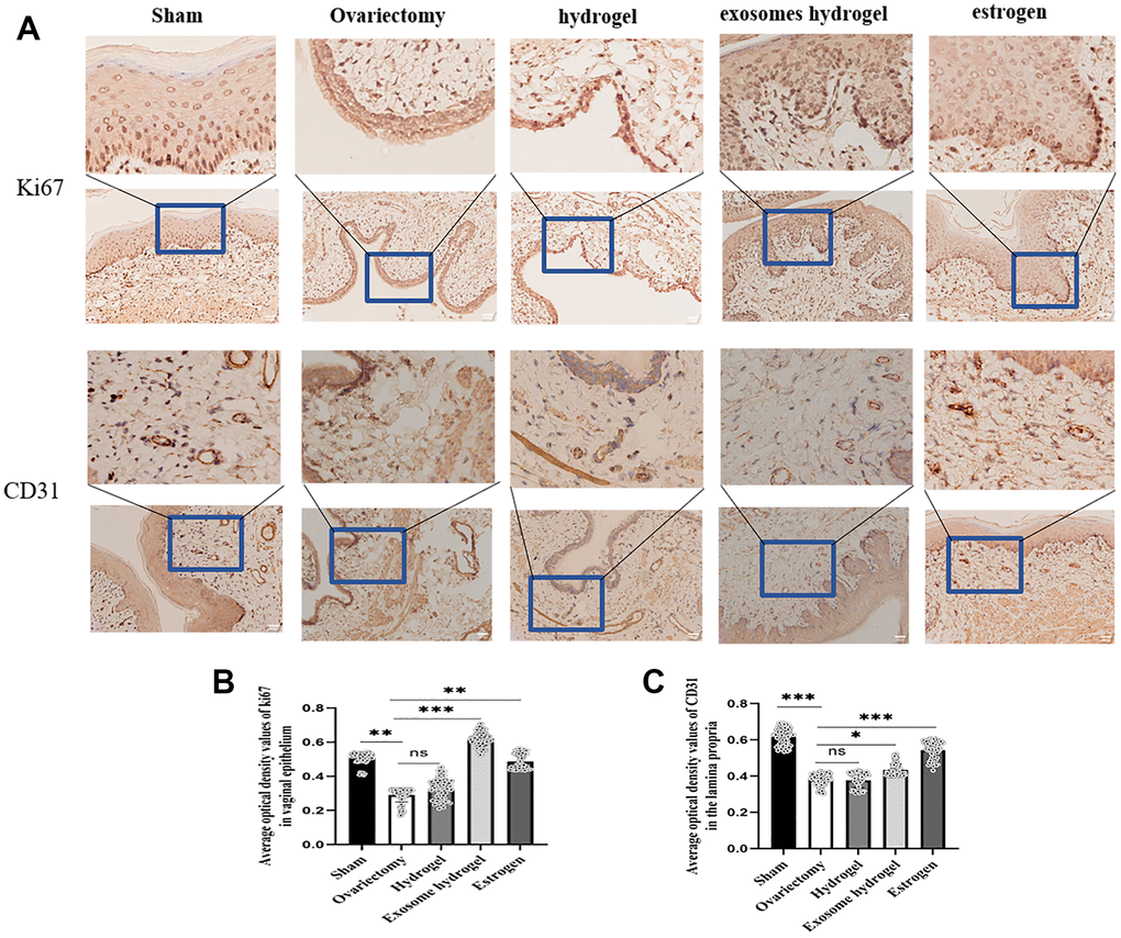 IHC analysis. (A) Average optical density analysis of ki67 and CD31 expression in the vaginal epithelium and lamina propria; (B, C) Quantification of ki67 and CD31 staining.