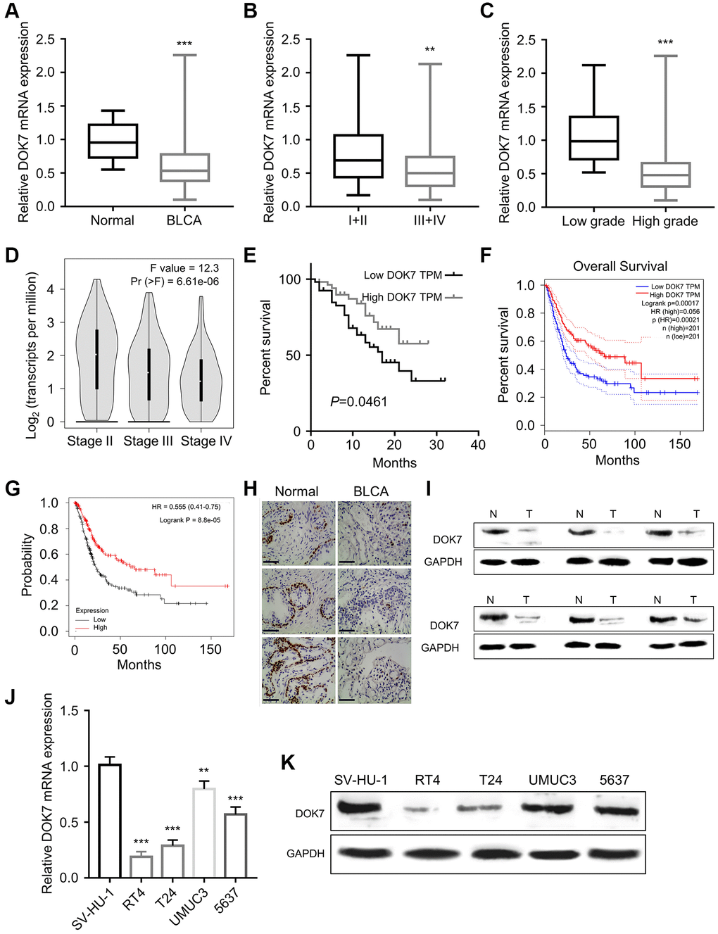 DOK7 expression is suppressed in BLCA tumor and cell lines. (A) The mRNA expression levels of DOK7 in 108 pairs of BLCA cancer tissues (BLCA) and corresponding adjacent tissues (Normal) were detected by RT-qPCR method. DOK7 expression was significantly decreased in BLCA, P  0.01; (B) The mRNA expression levels of DOK7 in BLCA tumor samples of different clinical stages (I+II and III+IV) were detected by RT-qPCR. DOK7 levels were significantly decreased in III+IV stage, P  0.01; (C) The expression levels of DOK7 in BLCA tumor samples of different histological grades (Low and High) were detected by qRT-PCR. DOK7 levels were significantly decreased in high grade tissues, P  0.001; (D) The expression levels of DOK7 in different clinical stages of TCGA-BLCA cancer tissues were analyzed by GEPIA. DOK7 levels were gradually decreased with the advancement of the clinical stage, P  0.001; (E) Kaplan–Meier (KM) curve analysis of the overall survival BLCA patients in DOK7 low-expression group (n = 54) and high-expression group (n = 54). The overall survival rate of the low-expression group was significantly lower than that of the high-expression group, P  0.001; (F) GEPIA online analysis of the TCGA BLCA cohort revealed the poor overall survival in BLCA patients with the low expression of DOK7; (G) K-M plotter online analysis found that the overall survival of BLCA patients with low expression of DOK7 was poor; (H) IHC staining of DOK7 protein expression levels in 3 pairs of cancer tissues and adjacent normal tissues under the magnification of 200X. DOK7 expression was significantly reduced in BLCA tumor tissues. The DOK7 staining was seen as dark signal in the nuclei, scale bar: 200 μm; (I) The protein levels of DOK7 in 6 pairs of BLCA cancer tissues and normal tissues were detected by WB. DOK7 protein levels were decreased in BLCA cancer tissues; (J) DOK7 mRNA expression levels in BLCA cell lines (RT4, T24, and UMUC3, 5637) and normal bladder cell line (SV-HU-1) were detected by RT-qPCR; (K) WB detection of DOK7 protein expression levels in BLCA cell lines and normal bladder cell line. **P ***P 
