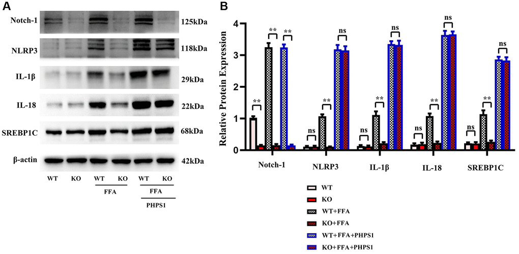 In vitro experiments verified that Notch-1MAC-KO regulated the correlation between the expression of inflammation-related factors and lipid synthesis in macrophages of HFD-induced NAFLD mice. (A) Protein band plots of Notch-1, NLRP3, IL-1β, IL-18 and SREBP1C. (B) Relative protein expression levels of Notch-1, NLRP3, IL-1β, IL-18 and SREBP1C. (**p *p p > 0.05; N = 3).