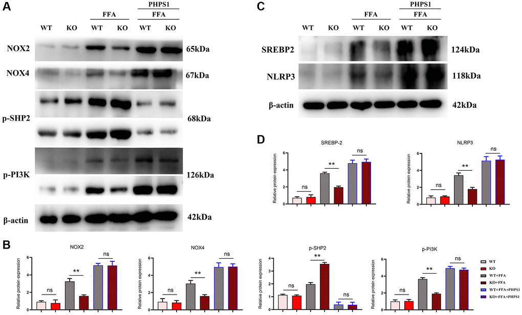 In vitro experiments verified that Notch-1MAC-KO regulated the expression of oxidative stress-related factors and associated proteins in macrophages of HFD-induced NAFLD mice. (A) Protein band plots of NOX2, NOX4, NLRP3, p-PI3K, p-SHP2 and SREBP2; (B) Relative protein expression levels of NOX2, NOX4, p-PI3K, NLRP3, p-SHP2 and SREBP2; (C) Protein band plots of NOX2, NLEP3, p-PI3K, p-SHP2 and SREBP2; (D) Relative protein expression levels of NOX2, NLEP3, p-PI3K, p-SHP2 and SREBP2. (**p *p p > 0.05; N = 3).