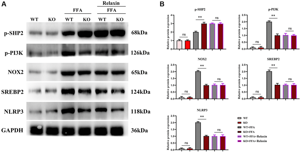 In vitro experiments have confirmed that Relaxin has a protective effect on the liver from anti-inflammation. (A) Protein band plots of NOX2, NLEP3, p-PI3K, p-SHP2 and SREBP2; (B) Relative protein expression levels of NOX2, NLEP3, p-PI3K, p-SHP2 and SREBP2. (**p *p p > 0.05; N = 3).
