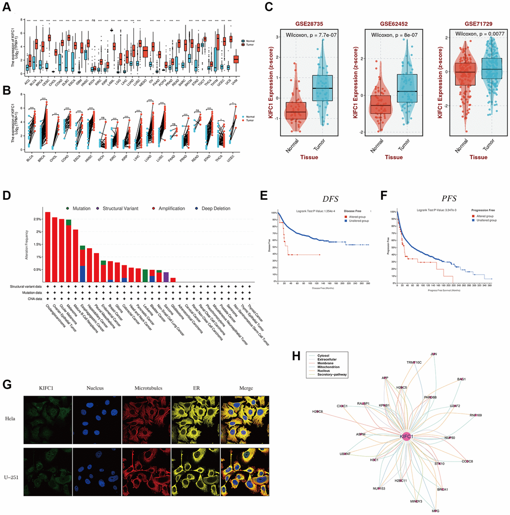 The expression level of KIFC1 in pan-cancer. (A) KIFC1 expression levels in different cancers with TCGA combined with GTEx database. (B) A paired comparison analysis was conducted using the Mann-Whitney U test to analyze the expression differences of KIFC1 in the tumor and corresponding adjacent tissues. (C) KIFC1 expression levels in GSE26735, GSE62452 and GSE71729. (D) Genetic alteration landscape (Mutation, Structural Variant, Amplification, and Deep Deletion) of KIFC1 in 30 different tumors based on the TCGA database through the cBioPortal tool. (E) Prognosis of DFS between KIFC1 altered and unaltered groups. (F) Prognosis of PFS between KIFC1 altered and unaltered groups. (G) The immunofluorescence images of the KIFC1 protein, nucleus, endoplasmic reticulum (ER), microtubules, and the merged images in Hela and U251 cell lines. (H) The protein-protein interaction (PPI) network presents the proteins interacting with KIFC1 ns p ≥ 0.05; *p **p ***p ****p 