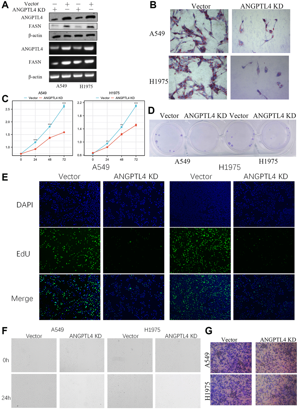 The effect of ANGPTL4 on LUAD cell proliferation, lipids production, migration and invasion. (A) The expression of ANGPTL4 and FASN in ANGPTL4 KD A549 and H1975 cell by WB and PCR. (B) The effect of ANGPTL4 KD on lipids metabolism by oil red O. MTT analysis (C), Clone formation assay (D), and EdU staining (E) were performed to confirm the effect of ANGPTL4 KD on cell proliferation. Wound healing assay (F) and Transwell invasion assay (G) were performed to confirm the effect of ANGPTL4 KD on cell migration and invasion. **P ***P 