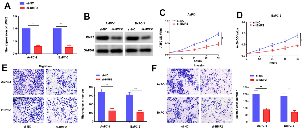 BMP2 inhibits PC cells proliferation and metastasis while it is knocking down. (A, B) The mRNA and protein of BMP2 affected by si-BMP2 siRNAs in PC cells. (C, D) CCK-8 assay with si-BMP2. (E, F) Transwell assay with si-BMP2 in PC cells. *p p 
