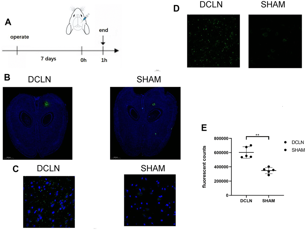 Effect of an impaired glymphatic system on Angiopep-2 efflux from the brain. (A) Seven days after bilateral DCLN ligation, 5 μl of FITC-Angiopep-2 (0.05 mg/μl, AP -5.0, ML 2.0, DV 3.0) was stereotaxically injected (AP, -5.0 mm; ML, −2.0 mm; DV, +3.0 mm) into the brain parenchyma. (B) Representative brain sections of the two groups (DCLN and SHAM; green, FITC-Angiopep-2; blue, DAPI, 2000 μm). (C, D) Confocal microscope imaging of representative brain sections (DCLN and SHAM; green, FITC-Angiopep-2; blue, DAPI, 50 μm). (E) Quantification of postinjection FITC-Angiopep-2 fluorescent counts in the brain tissue of the two groups. Significance level: **P 