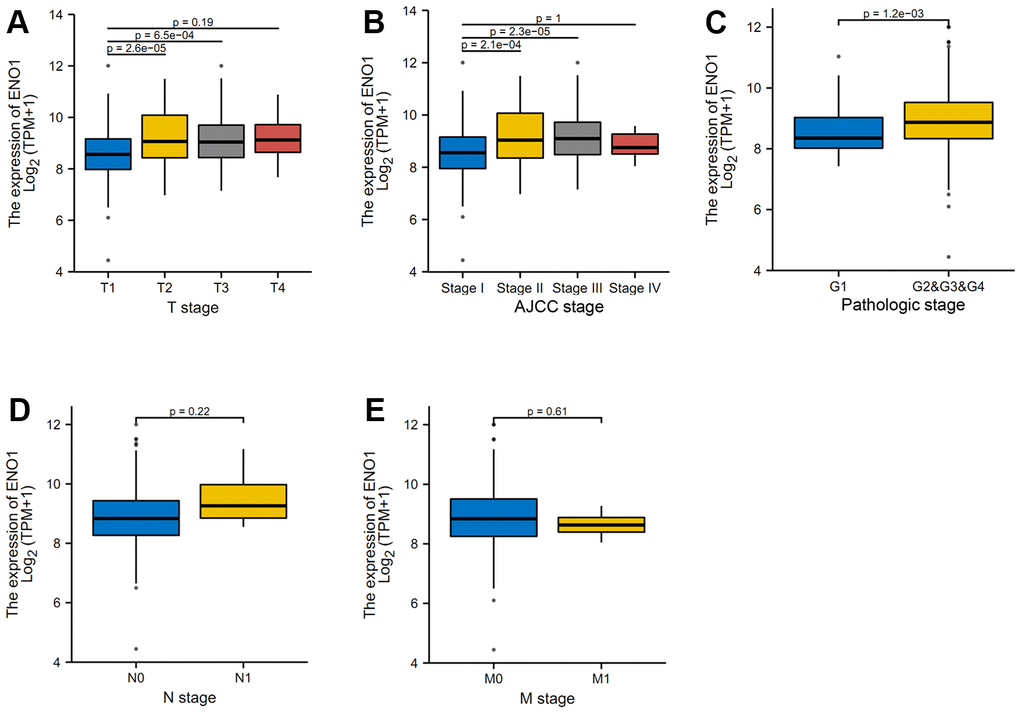 High expression of hub gene ENO1 suggests disease progression. (A) The clinical correlation analysis of ENO1 gene expression and tumor size and stage. The expression of ENO1 in different tumor stages (B), and in the pathological Grade stage (C). ENO1 was not associated with lymph node status (D) or distant metastatic status (E).