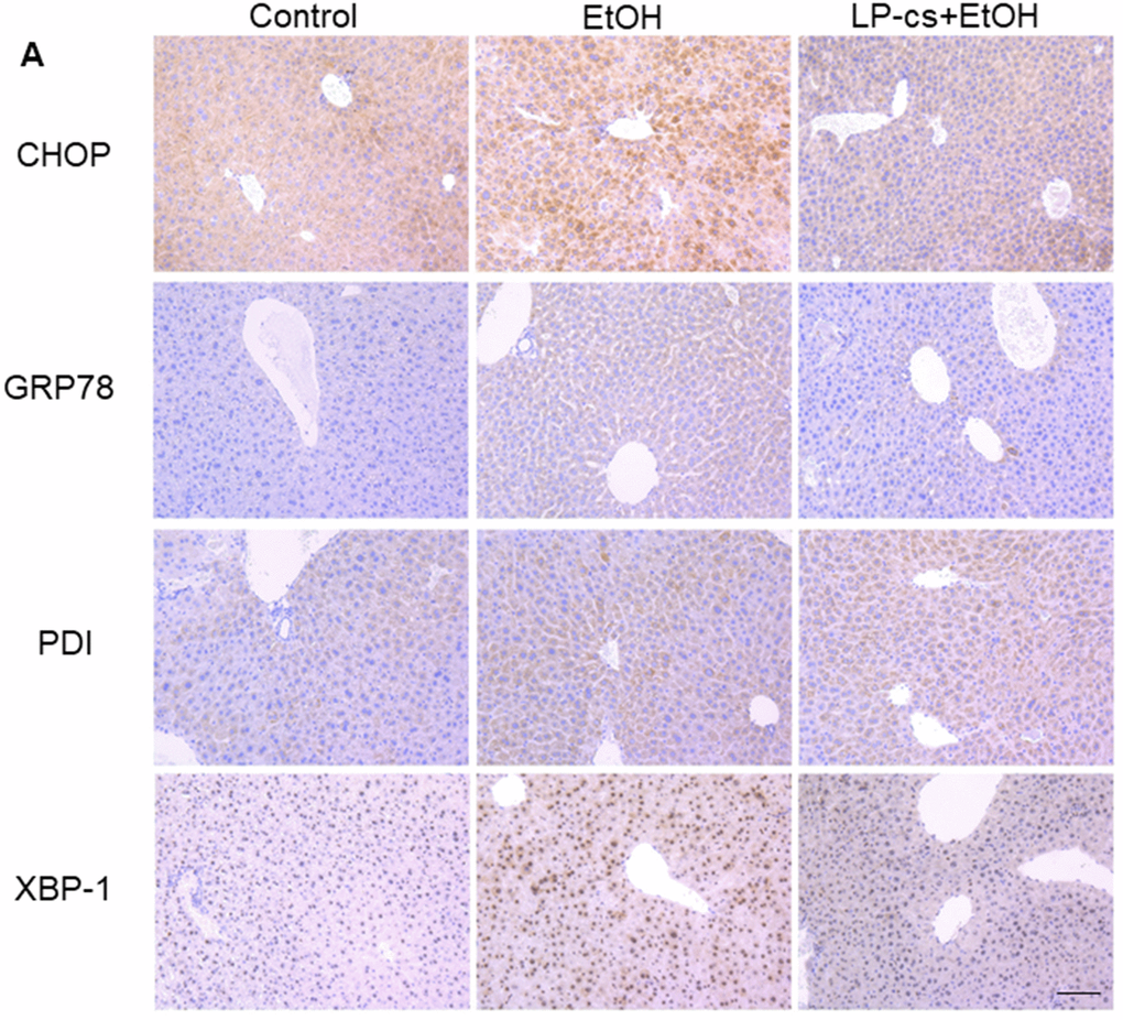 Lactobacillus plantarum ST-III culture supernatant (LP-cs) ameliorates acute alcohol-induced liver ER stress. (A) Immunohistochemistry staining of C/Ebp-homologous protein (CHOP), glucose-regulated protein 78 (GRP78), protein disulfide isomerase (PDI), and X box-binding protein-1 (XBP-1) positive area of liver from control, EtOH, and LP-cs +EtOH mice (20 x: scale bars = 50 μm).