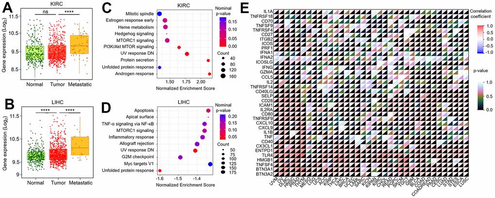 Correlation between TMX4 expression and tumor metastasis, immune-checkpoint-related genes. The expression level of TMX4 in normal, tumor and metastatic tissues of KIRC (A). The expression level of TMX4 in normal, tumor and metastatic tissues of LIHC (B). GSEA results showing differential enrichment of signaling pathway with high TMX4 expression phenotype in KIRC (C). GSEA results showing differential enrichment of signaling pathway with high TMX4 expression phenotype in LIHC (D). The correlation between TMX4 expression and immune-checkpoint-related genes in different cancer types (E). *p 