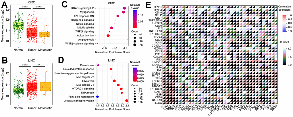 Correlation between TMX2 expression and tumor metastasis, immune-checkpoint-related genes. The expression level of TMX2 in normal, tumor and metastatic tissues of KIRC (A). The expression level of TMX2 in normal, tumor and metastatic tissues of LIHC (B). GSEA results showing differential enrichment of signaling pathway with low TMX2 expression phenotype in KIRC (C). GSEA results showing differential enrichment of signaling pathway with high TMX2 expression phenotype in LIHC (D). The correlation between TMX2 expression and immune-checkpoint-related genes in different cancer types (E). *p 