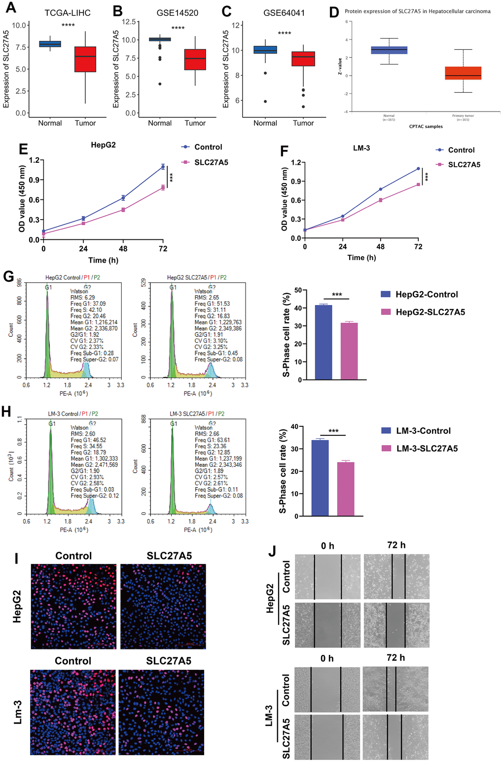 The expression and function of SLC27A5 in HCC. (A–C) The transcriptional expression of SLC27A5 in HCC and normal tissues of TCGA-LIHC (A), GSE14520 (B) and GSE64041 (C) datasets. (D) The protein level of SLC27A5 in HCC and normal tissues. (E, F) CCK-8 assay for HepG2 (E) and LM-3 (F) cells overexpressing SL27A5. (G, H) HepG2 (G) and LM-3 (H) cells were subject to flow cytometry analysis for cell cycle. (I) HCC cells overexpressing SLC27A5 were subject to EdU staining. (J) HCC cells overexpressing SLC27A5 were subject to wound healing assay.