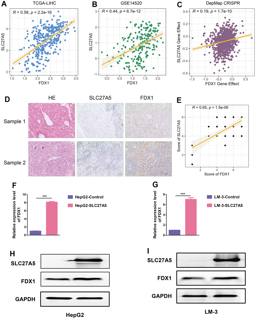 SLC27A5 upregulates FDX1 in HCC. (A, B) The correlation between the expression of SLC27A5 and that of FDX1 in TCGA-LIHC (A) and GSE14520 (B) datasets. (C) Dot plot showing the dependency scores for SLC27A5 and FDX1 across all tumor cell lines in the Project Achilles/Cancer Dependency Map Portal (DepMap). (D, E) The expression of and correlation between SLC27A5 and FDX1 in collected HCC tissue chip. (F, G) HepG2 (F) and LM-3 (G) cells overexpressing SLC27A5 were subject to qRT-PCR analysis. (H, I) Western blotting using lysates of HepG2 (H) and LM-3 (I) cells after overexpressing SLC27A5.