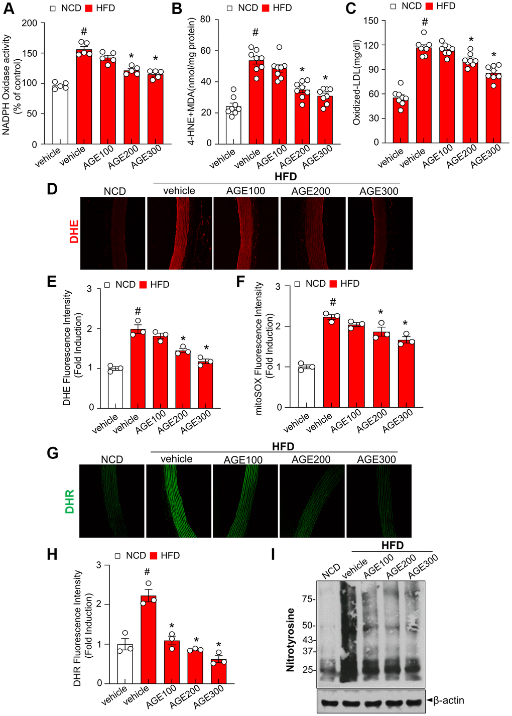 AGE inhibits oxidative stress in hyperlipidemic rats. (A) NADPH oxidase activity determined via lucigenin chemiluminescence assay. (B) 4-HNE + MDA level was measured as described in Materials and Methods. (C) Oxidized low-density lipoprotein (Ox-LDL) cholesterol content in plasma. (D) Representative images of DHE staining for ROS production and (E) quantification of DHE fluorescence intensity for ROS levels in aortas. (F) Quantification of mitoSOX fluorescence intensity for mitoROS levels in aortas. (G) Representative images of DHR staining for peroxynitrite in aortas and (H) quantification of DHR fluorescence intensity for peroxynitrite levels in aortas. (I) Nitrotyrosine analysis was performed as was described in Materials and Methods. Values are presented as mean ± SEM (n = 4~9, #p *p Angelica gigas NAKAI extract.