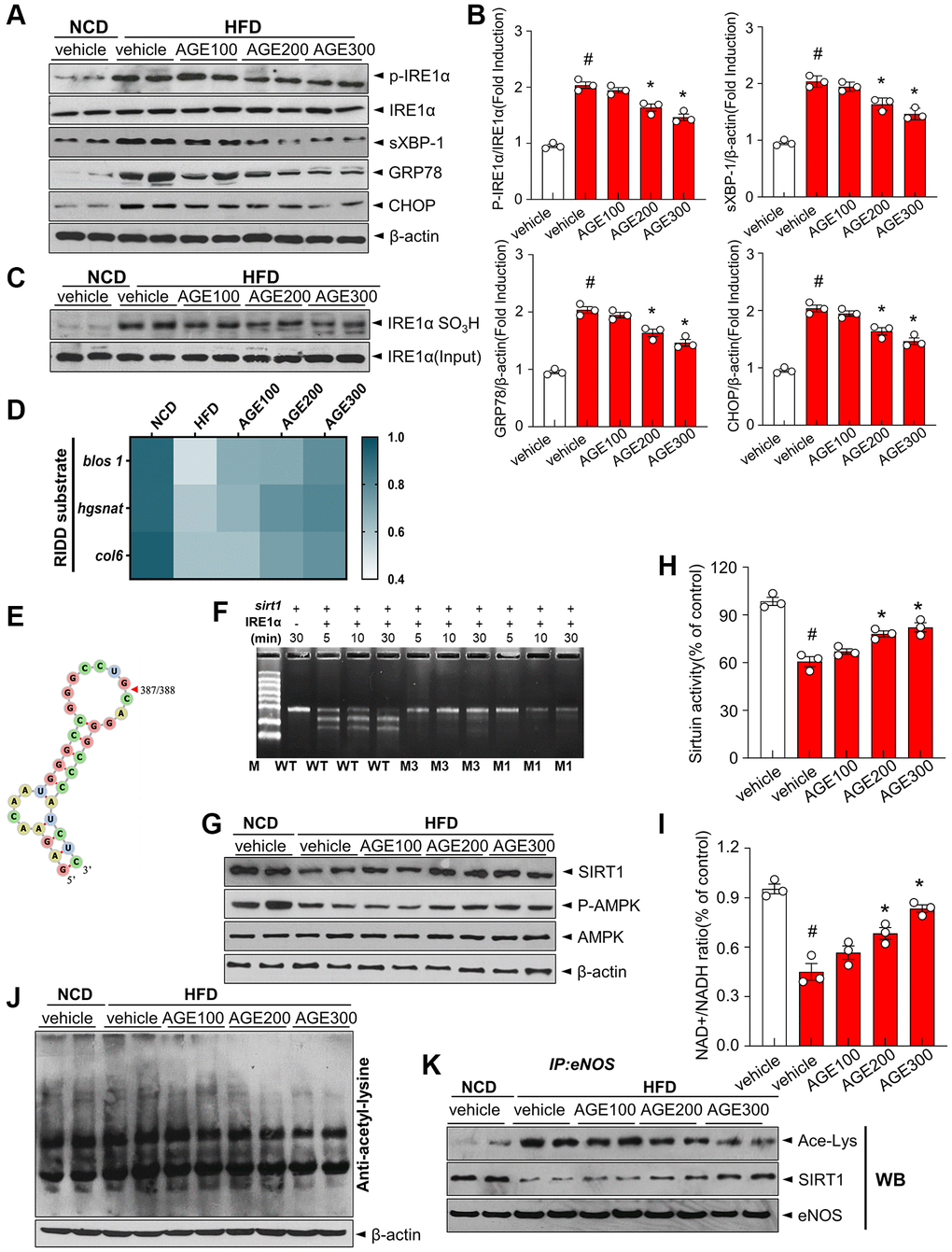 AGE regulates ER stress and IRE1α sulfonation in vascular dysfunction model. (A) Immunoblotting of p-IRE1α, IRE1α, sXBP-1, GRP78, CHOP and β-actin expressions in aorta and (B) respective quantitative analysis of protein expressions. (C) Immunoblotting with anti-IRE1α SO3H and IRE1α antibodies in aortas. (D) Heatmap depicting mRNA expression of genes identified as RIDD substrates in the aorta. (E) RNA fold prediction in the secondary structure of mRNA fragments of sirt1. (F) In vitro cleavage assay using 1.5% denaturing agarose gel. Sirt1 mRNA cleaved by IRE1α with its two mutant mRNAs during the indicated times. (G) Immunoblotting of SIRT1, p-AMPK, AMPK, and β-actin in aorta from the indicated groups. (H) Sirtuin activity and (I) NAD+ and NADH levels were measured, and NAD+/NADH ratios were quantified. (J) Acetylated lysine levels and β-actin expression were determined using immunoblotting. (K) eNOS was immunoprecipitated from aorta tissues from the indicated groups, and its acetylated-lysine level was analyzed via immunoblotting with anti-acetyl-lysine and anti-SIRT1 antibody. Data are presented as mean ± SEM (n = 3, #p *p Angelica gigas NAKAI extract.