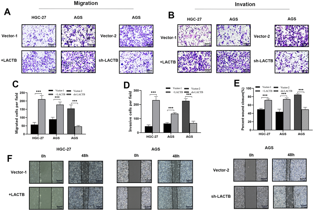 The effect of LACTB on the migration and invasive ability of gastric cancer cells. (A–D) The effect of LACTB on the migration and invasion ability of HGC-27 and AGS. (E, F) Effects of LACTB on the migration ability of HGC-27 and AGS. ***P