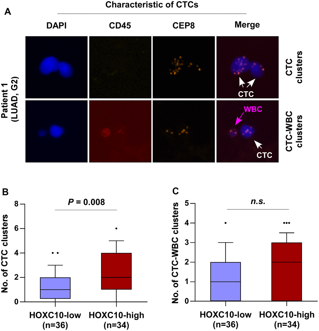 HOXC10 expression is positively correlated with the number of CTC clusters in LUAD patients. (A) Identification of CTC clusters and CTC-WBC clusters in LUAD patients by SE-iFISH platform. (B) Number of CTC clusters in HOXC10-low (n=36) and HOXC10-high expression (n=34) LUAD patients. (C) Number of CTC-WBC clusters in HOXC10-low (n=36) and HOXC10-high expression (n=34) LUAD patients.