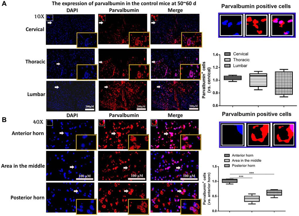 The expression of parvalbumin (PV) in different positions of spinal cord. (A) The expression of PV in cervical, thoracic and lumbar segments in the control mice. Scale bar = 200 μM. The yellow boxes represent the typical PV positive cells (enlarged approximate twice on the original position). The typical PV positive cells are enlarged approximate 4 times and shown on the top right panel. (B) The expression of PV in the anterior horn of gray matter, posterior horn and the area in the middle of gray matter in the control mice. The yellow boxes represent the typical PV positive cells (enlarged approximately twice on the original position). The typical PV positive cells are enlarged approximately 4 times and shown on the middle right panel. Scale bar = 100 μM. ***P n = 6).