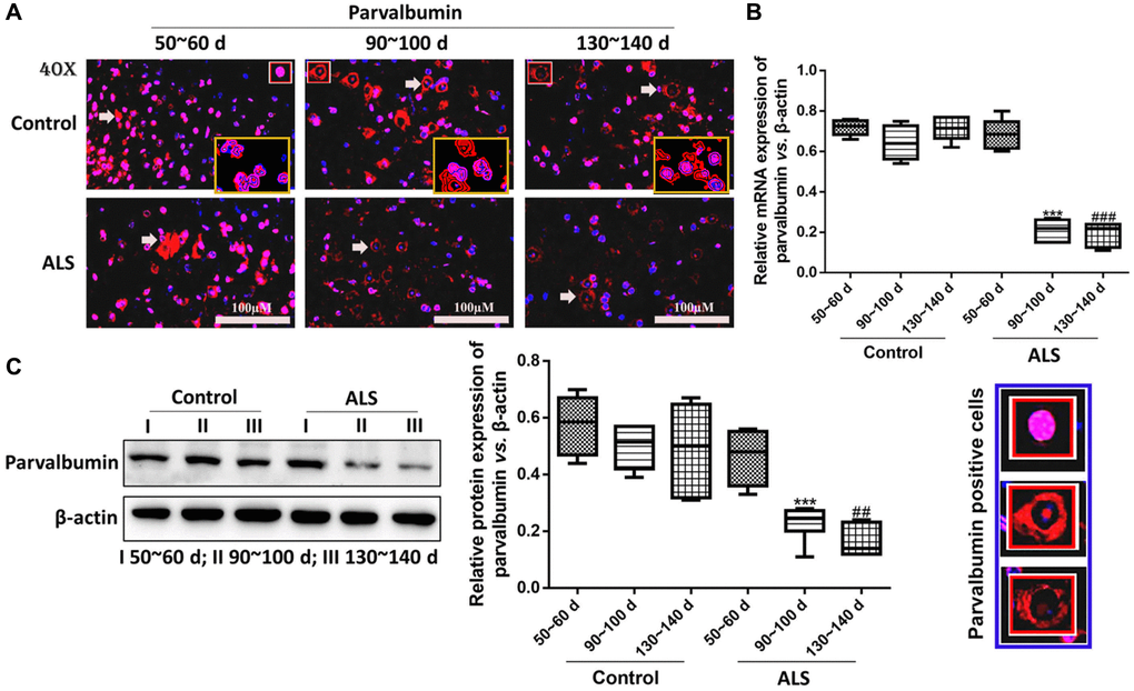 PV interneurons in the spinal cord of ALS mice with different age by immunofluorescence. (A) The yellow boxes represent the typical positive cells (enlarged approximate twice on the original position). The typical PV positive cells are enlarged approximate 4 times and shown on the bottom right panel. Scale bar = 100 μM. PV interneurons in the spinal cord of ALS mice with different age by RT-qPCR (B) and western blot (C). ***P ###P ##P n = 6).