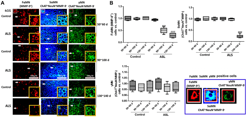 Different motoneurons in the spinal cord of ALS mice with different onset time. Different MNs are stained with different markers and colors, FαMNs (MMP-9+), SαMNs (ChAT+NeuN+MMP-9−) and (ChAT+NeuN−MMP-9−), with MMP-9+ (red), ChAT+ (green) and NeuN+ (blue). Scale bar = 100 μM (A) and the quantitative results (B). The yellow boxes represent the typical positive cells (enlarged approximate twice on the original position). The typical MMP-9+, ChAT+NeuN+MMP-9− and ChAT+NeuN−MMP-9− positive cells are enlarged approximately 4 times and shown on the bottom right panel. &&&P ***P ###P n = 6).