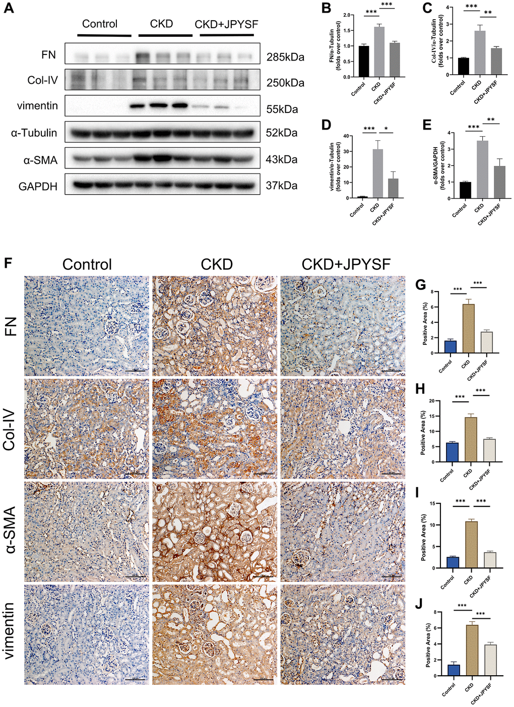 The effects of JPYSF on renal fibrosis in CKD mice. (A) Representative Western blot images of FN, Col-IV, α-SMA, and vimentin expression in the kidney of mice. (B–E) Quantitative analysis of FN, Col-IV, α-SMA and vimentin normalized to α-Tubulin or GAPDH content (n = 6). (F–J) Representative immunohistochemical images and quantitative analysis of positive staining areas of FN, Col-IV, α-SMA and vimentin in the kidney of mice (n = 3). All images are shown at identical magnification, ×200, scale bar = 100 μm. Data are expressed as mean ± SEM (*p **p ***p 