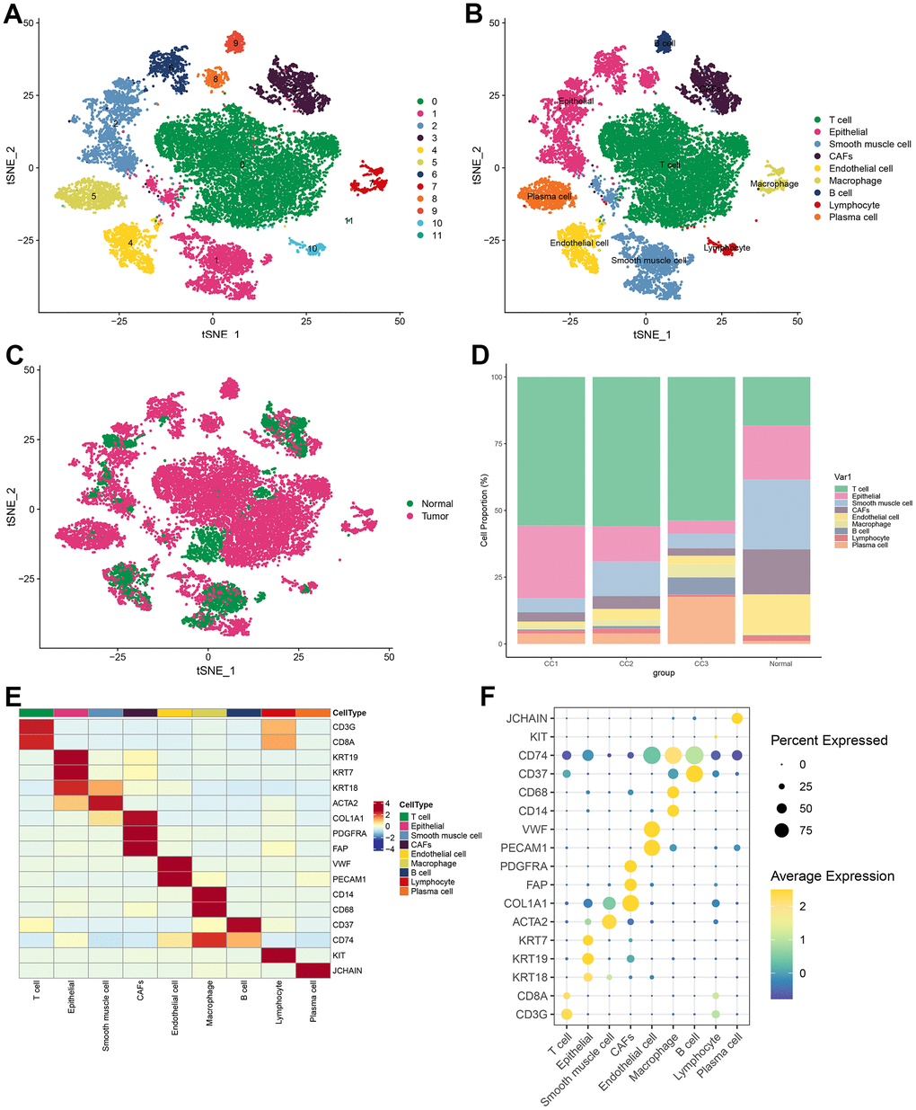 Visualization of tSNE for cell descending clustering. (A) tSNE plot of 12 cell clusters; (B) tSNE plot of 9 cell types; (C) tSNE plot of normal and tumor cells; (D) Proportion of each cell type in different samples; (E) Heat map of marker gene expression for 9 types of cells; (F) Bubble map of marker gene expression for 9 types of cells.