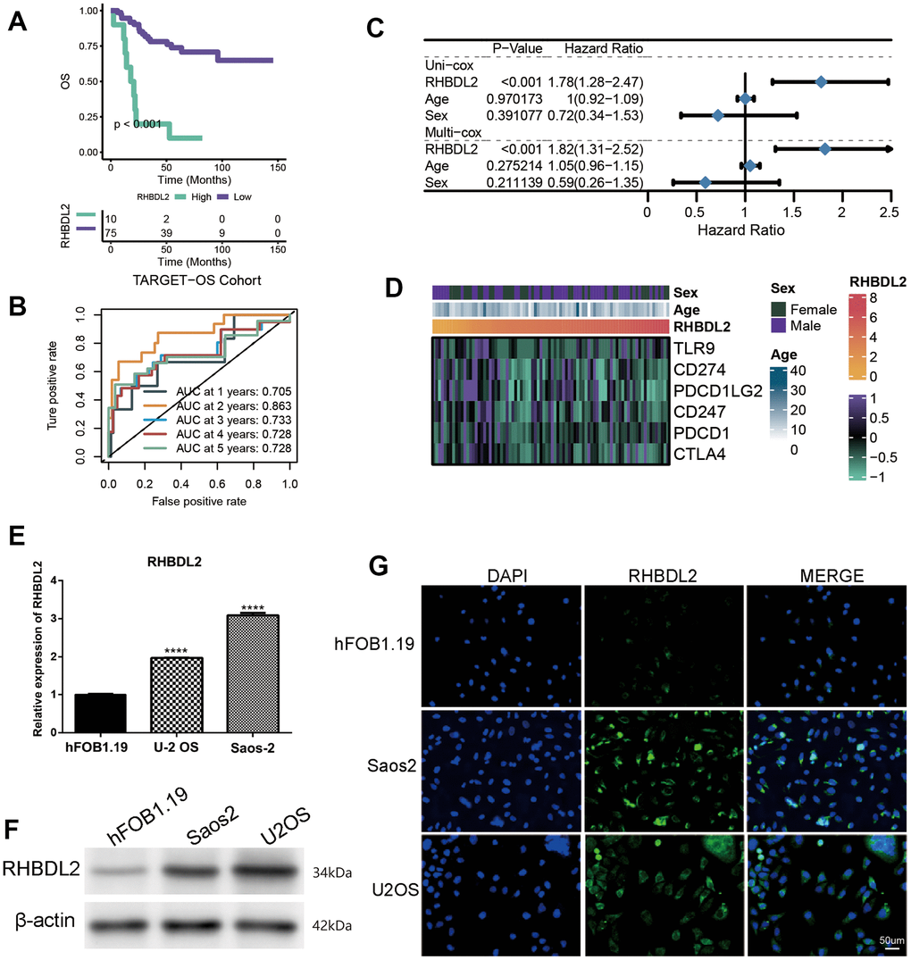Importance of RHBDL2 in TARGET-OS cohort. (A) Kaplan-Meier survival curve showing survival probability of high- or low-expression RHBDL2; (B) The 1-year, 2-year, 3-year, 4-year, and 5-year survival ROC curves predicted by the expression of RHBDL2, with curves in different colors representing the AUC for different years; (C) The forest figure for Univariate and Multivariate Cox regression analyses of RHBDL2 and clinicopathologic features (Age, Sex); (D) The relationship of RHBDL2 with immune checkpoints in TARGET cohort; (E) Quantitative Real-time PCR. (A–C) Quantitative Real-time PCR assays using cell lines for RHBDL2; (F) The protein expression levels of ENO1 and CD44 in HK-2 cell control group and hyperglycemic group by Western blot; (G) The detection of RHBDL2 in tumor cells and normal cells by immunofluorescence.