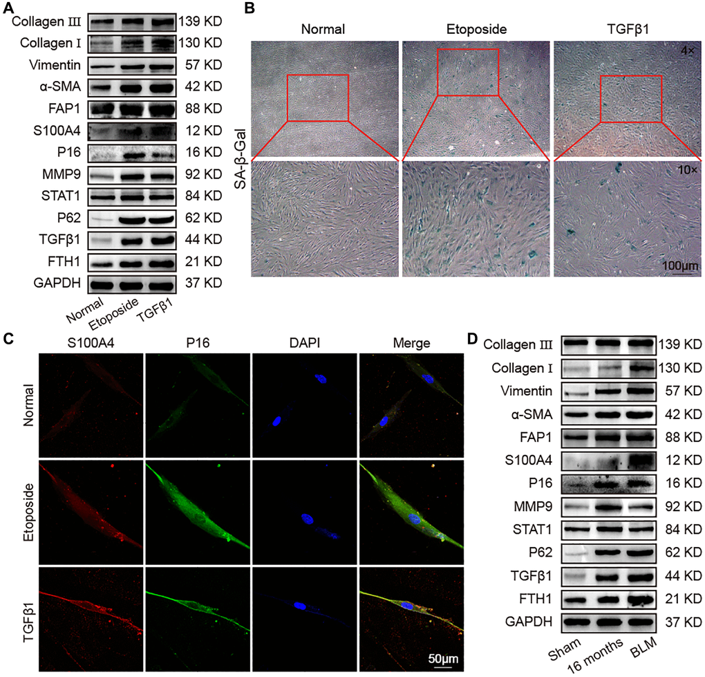 Identification of senescence and fibrosis markers in an aging cell model, fibrotic cell model, and fibrotic mouse model. Aging cell models were established in MRC-5 cells using 10 μM etoposide, and 5 ng/mL TGFβ1 was used to establish a fibrotic cell model in MRC-5 cell. The BLM model group was sprayed with 5 mg/kg BLM through the trachea by using a Penn–Century MicroSprayer. (A) The expression levels of collagen III, collagen I, vimentin, α-SMA, FAP1, S100A4, P16, MMP9, STAT1, P62, TGFβ1, and FTH1 increased in the etoposide and TGFβ1 groups compared with those in normal mice. (B) SA-β-gal-positive cells increased in the TGFβ1-stimulated group, but the etoposide group had more β-gal-positive cells than the normal and TGFβ1 groups. SA-β-gal-positive cells are blue. (C) Double immunofluorescence staining showed that S100A4 and P16 were significantly highly expressed in the etoposide and TGFβ1 groups, but S100A4 in the TGFβ1 group was higher than that in the etoposide group, and P16 in the etoposide group was higher than that in the TGFβ1 group. (D) The expression levels of collagen III, collagen I, vimentin, α-SMA, FAP1, S100A4, P16, MMP9, STAT1, P62, TGFβ1, and FTH1 in lung tissue of aged and fibrotic mice were significantly higher than that of the sham group.