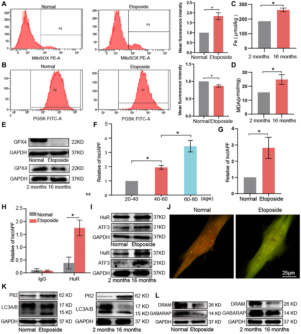 Key molecular players of ferroptosis and autophagy signaling pathways in aging. (A) Flow cytometry assay showed that ROS expression increased in senescent cells compared with normal ones. (B) Senescent cells expressed more ferric ions than normal ones. (C) Total iron increased in lung tissue of 16-month-old mice compared with the 2-month-old group. (D) MDA increased in lung tissues of 16-month-old mice compared with the 2-month-old group. (E) Western blot showed that GPX4 expression decreased in aging cells compared with normal cells in vivo and in vitro. (F) qRT-PCR results showed that lncIAPF expression increased with age in a group of healthy population. (G) qRT-PCR results showed that lncIAPF expression increased in the aging cell model than those in the normal one. (H) RIP results verified that HuR specifically concentrated large quantities of lncIAPF. (I) Western blot confirmed that the expression levels of ATF3 and HuR increased in the aging cell model and lung tissue compared with those in the normal group. (J) Application of dual-fluorescence mRFP-GFP-LC3 adenovirus monitoring to observe autophagy under laser confocal microscopy revealed that the number of yellow autophagosomes increased in the aging group compared with the normal one. (K) Western blot showed that P62 and LC3A/B increased in the aging group compared with the normal one. (L) Western blot showed that DRAM and GABARAP decreased in the aging group compared with the normal one. Each bar represents the mean ± SD; n = 3; *p 