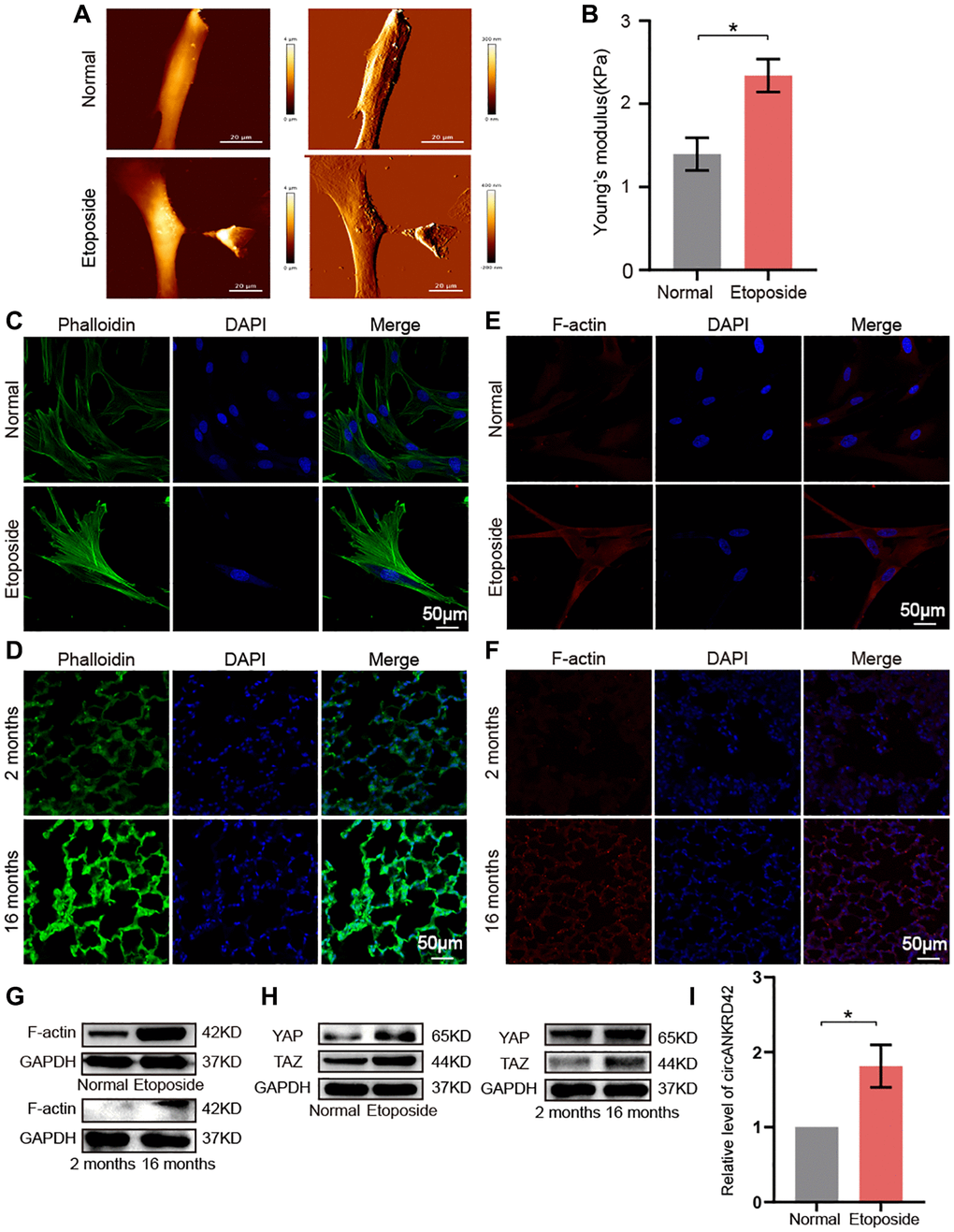 circANKRD42 mediated the aging-inducing mechanical forces. (A) AFM images showed that Young’s modulus increased in senescent cells compared with normal ones. (B) The reaction force of senescent cells was higher than that of normal cells. (C) Phalloidin staining depicted that the cytoskeleton became disordered and underwent disorganized expansion in the aging cell model compared with that in the normal one. (D) Phalloidin staining depicted that the cytoskeleton became disordered and underwent disorganized expansion in the lung tissue of 16-month-old mice compared with the 2-month-old ones. (E) Immunofluorescent staining showed that F-actin was highly expressed in aging cells compared with that in the normal one. (F) Immunofluorescent staining showed that F-actin was highly expressed in aging lung tissue than in the young. (G) Western blot showed that the expression level of F-actin increased in the aging cell and tissue model compared with those in the normal one. (H) Western blot showed that the expression levels of YAP and TAZ increased in the aging cell and tissue model compared with those in the normal one. (I) qRT-PCR result revealed that circANKRD42 expression increased in the aging cell model compared with those in the normal one. Each bar represents the mean ± SD; n = 3; *p 