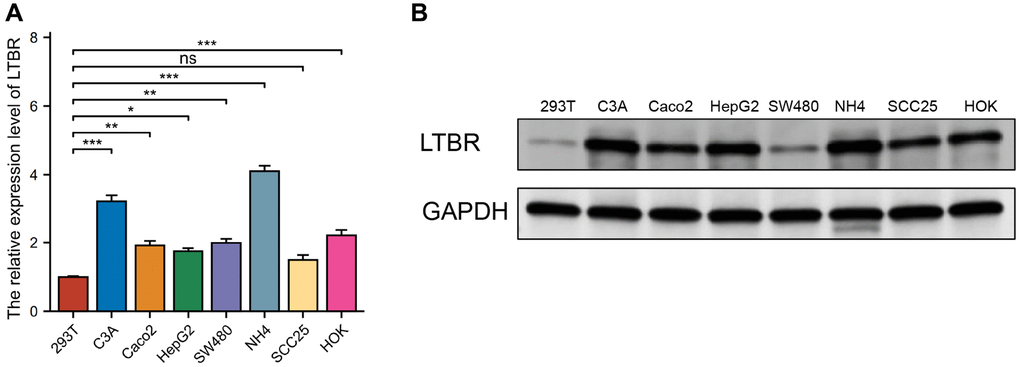 Validation of expression of the LTBR gene. (A) RT-qPCR results revealed elevated levels of LTBR expression in most cancer cell lines. (B) Western blot results indicated an increased protein level of LTBR across the majority of pan-cancer cell lines, compared to the normal cell lines.