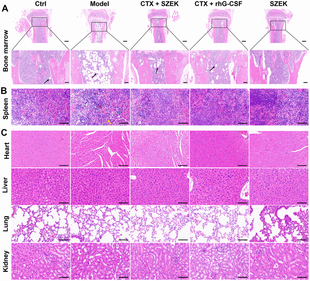 SZEK improves histopathology in mice with hematopoietic dysfunction. SZEK restores histomorphology in (A) bone marrow (5×, scale bar: 200 μm; 20×, scale bar: 50 μm) and (B) spleen (200×, scale bar: 100 μm) of mice with hematopoietic dysfunction without affecting the tissue morphology of (C) heart, liver, lung, and kidney (200×, scale bar: 100 μm). The black arrow shows myeloid cell adipocytosis in A. In B, lymphocytes are denoted by red arrows, multinucleated macrophages are denoted by blue arrows, and neutrophils are denoted by yellow arrows. Ctrl, control; Model, hematopoietic dysfunction model.