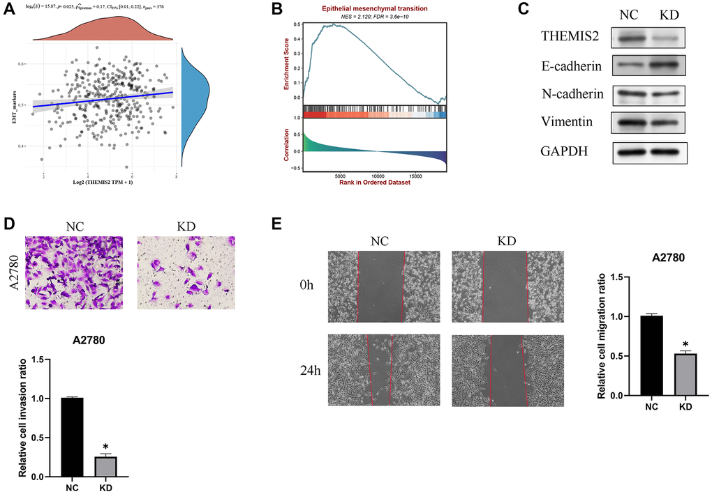 Knockdown of THEMIS2 in OC cells inhibits cell migration and invasion. (A) THEMIS2 was positively correlated with EMT-related markers. (B) EMT-related pathways were significantly enriched in highly expressed THEMIS2. (C) The expression of EMT-related proteins was significantly affected after THEMIS2 knockout. (D) The invasion ability of OC cells was significantly reduced after THEMIS2 knockdown. (E) The migratory ability of OC cells was significantly reduced after THEMIS2 knockdown.