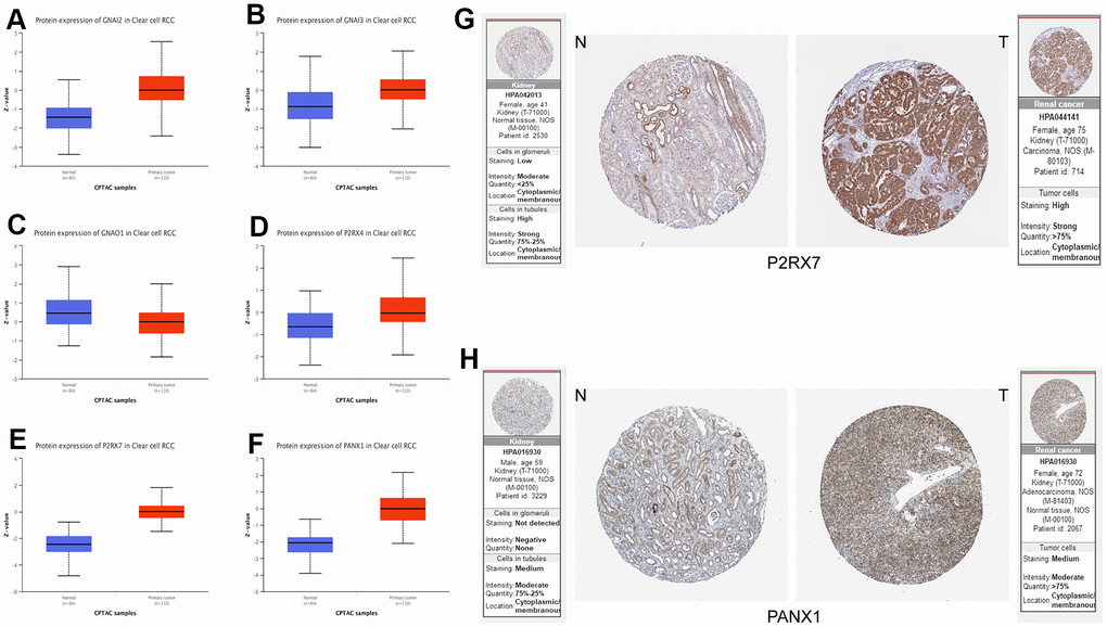 (A–F) Protein expression data of Purinergic genes GNAI2, GNAI3, GNAO1, P2RX4, P2RX7, PANX1 in normal tissues vs. KIRC tissues from UALCAN database. (G, H) Immunohistochemical images of Purinergic genes P2RX7 and PANX1 in normal tissues compared with kidney cancer tissues in the HPA database.