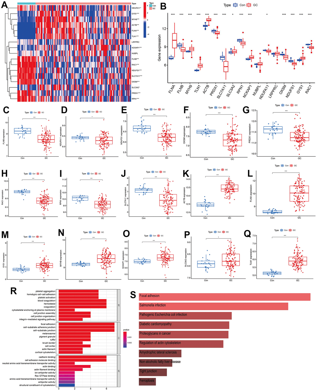 Identification of the 17 disulfidptosis modulators in GC. (A) Expression heat map of the 17 disulfidptosis modulators in controls and GC cases. (B) Differential expression boxplot of the 17 disulfidptosis modulators between controls and GC cases. (C–Q) Differential expression boxplot of 15 significant disulfidptosis modulators identified between controls and GC cases. (R–S) GO and KEGG enrichment analysis based on the 15 significant disulfidptosis modulators. *p 