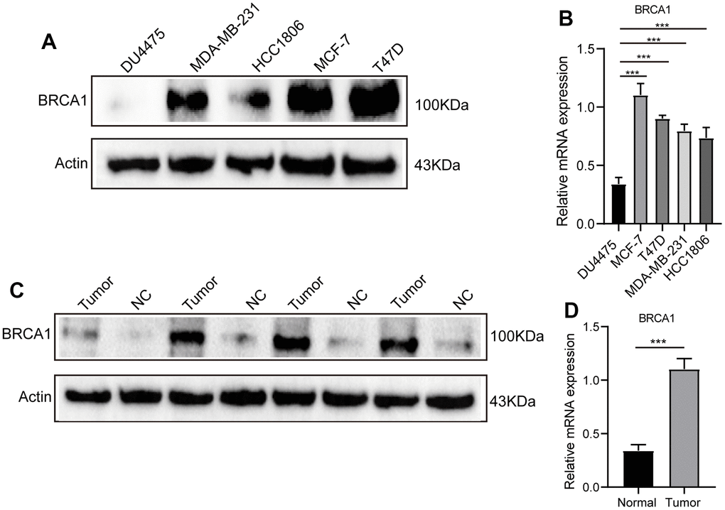 WB and RT-qPCR were used to detect the level of BRCA1 in BRCA. (A) WB and RT-qPCR (B) results showed that the expression of BRCA1 in breast cancer cells was higher than that in normal breast epithelial cells. (C) WB and RT-qPCR (D) results revealed that the level of BRCA1 in breast cancer tissues was higher than that in paracancerous tissues. The experiments were repeated 3 times. Data are shown as means ± SD. P-values were calculated with two-tailed unpaired Student’s t-test, *p p p 