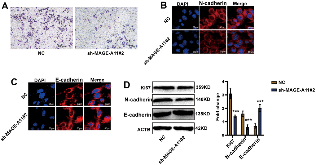 AGE-A11 has the ability to regulate tumor cell migration. (A) Transwell assay was used to detect the effect of MAGE-A11 knockout on cell migration ability. (B) Detection of N-cadherin by cellular immunofluorescence. (C) Detection of E-cadherin by cellular immunofluorescence. (D) The changes of cell proliferation and migration protein markers were detected by western blot.