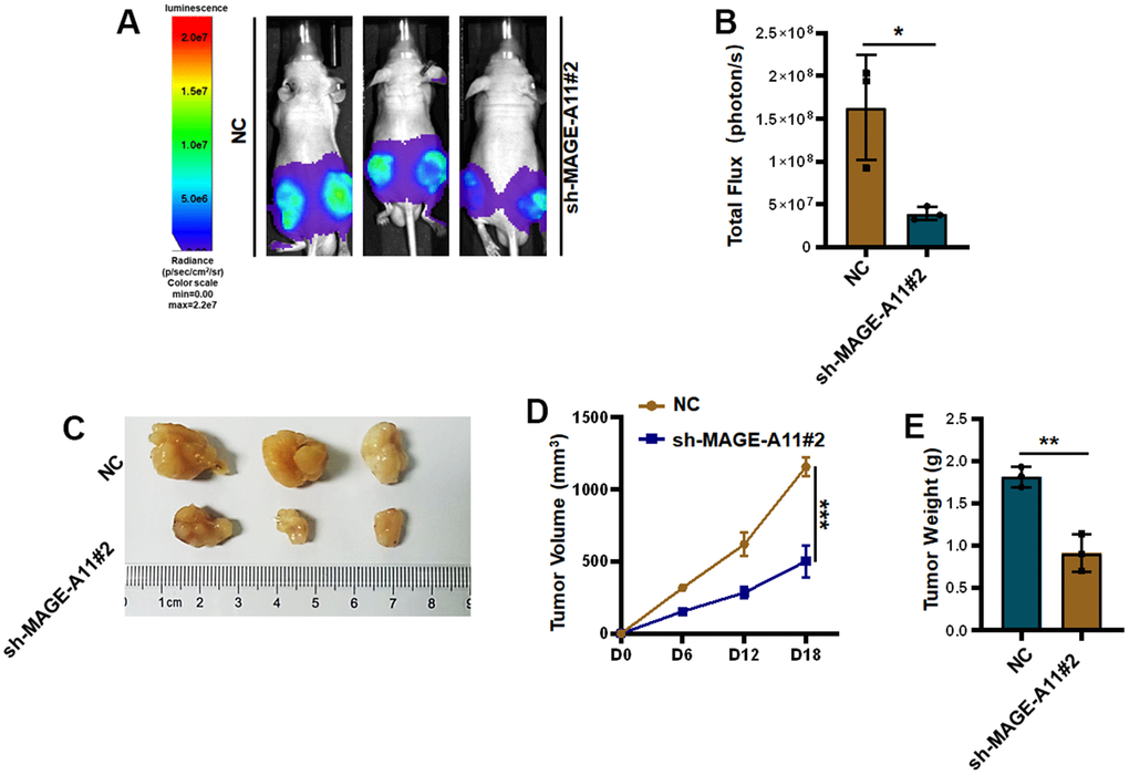 Knockout of MAGE-A11 affects tumor growth in vivo. (A) Animal imaging image. (B) Fluorescence value of animal imaging. (C) Image of tumor in experimental group and control group. (D) Tumor volume curve (E) tumor weight.