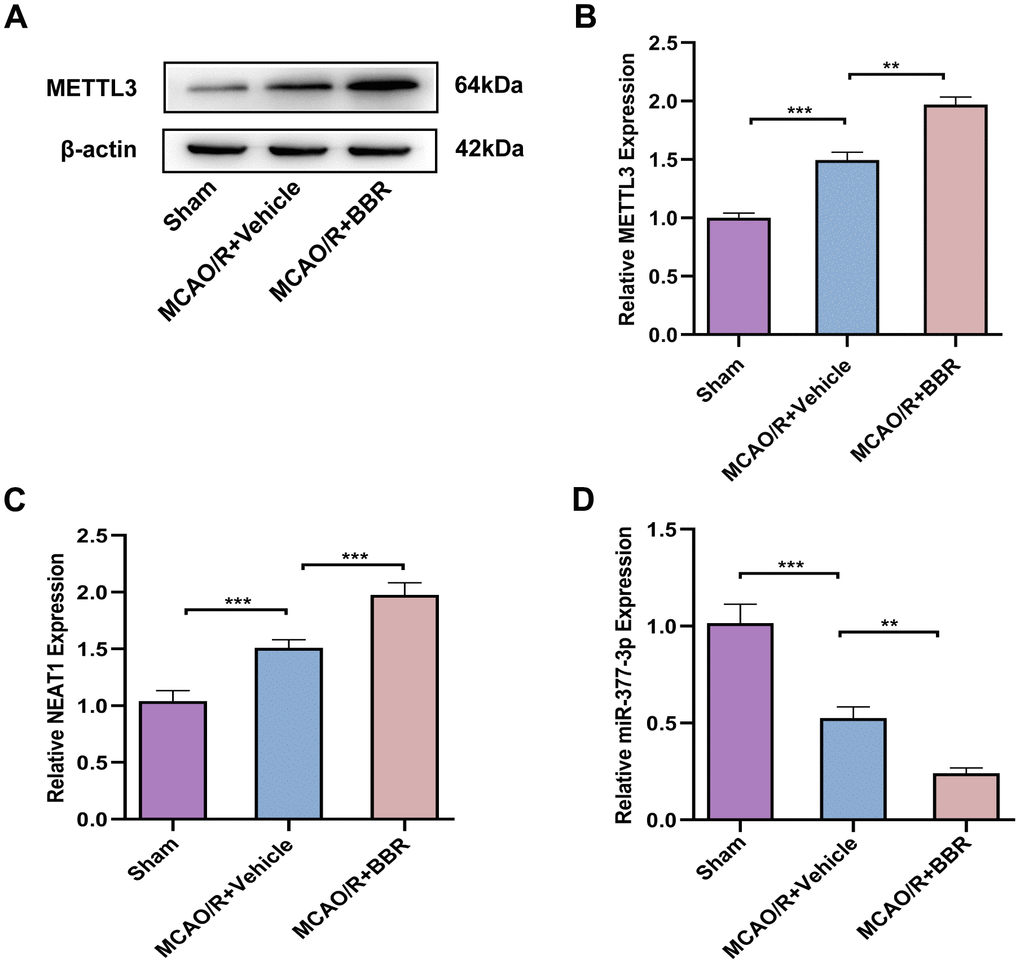 Berberine regulates METTL3-mediated m6A modification of NEAT1 to alleviate ischemic stroke in adult mouse astrocytes. (A) Western blot to verify METTL3 expression in adult mouse astrocytes after berberine administration following MCAO/R. (B) A bar presenting the quantification of METTL3. (C) RT-qPCR for NEAT1 expression in adult mouse astrocytes after berberine administration following MCAO/R. (D) RT-qPCR to verify the expression of miR-377-3p in adult mouse astrocytes after berberine administration following MCAO/R. The relative expression levels were quantified by normalizing to β-actin. Data are represented as mean ± SD, (n = 6; **P P 