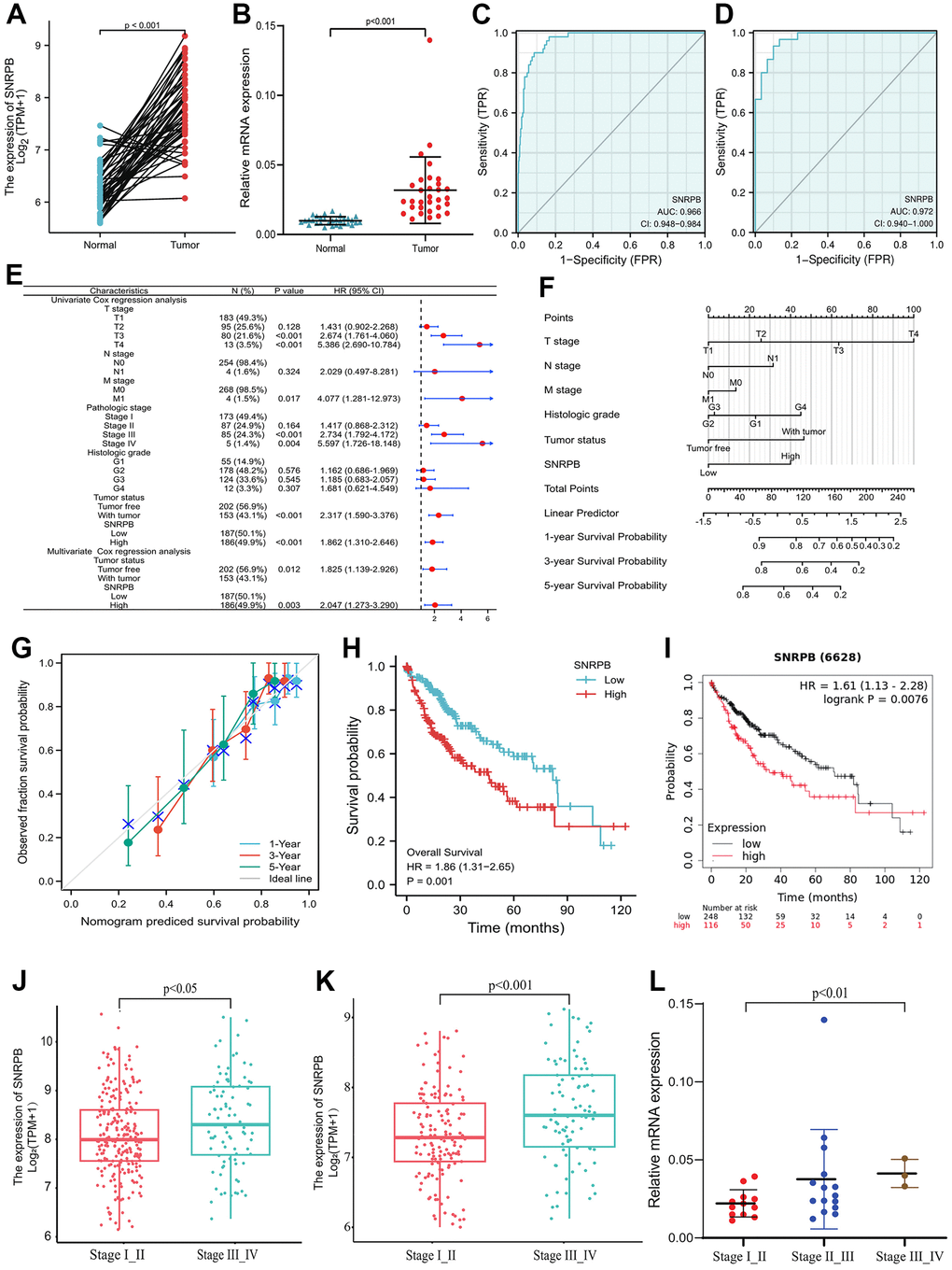 Correlation of SNRPB and the clinicopathological features and survival rates of patients with HCC. (A) mRNA relative expression levels of SNRPB in HCC tissues and paired adjacent tissues acquired from TCGA. (B) mRNA relative expression levels of SNRPB in 30 HCC tissues and 30 paired adjacent tissues. (C) ROC analysis of the diagnosis of SNRPB in HCC patients using data obtained from TCGA. (D) ROC analysis of SNRPB expression in 30 HCC and 30 paired adjacent tissues. (E) Forest plot using univariate and multivariate Cox regression analysis. (F) Nomogram of the overall survival (OS) for patients with HCC (1, 3, and 5 years). (G) Calibration curve of OS at 1, 3 and 5 years. The gray diagonal is the ideal case line and the blue cross represents the result of hierarchical Kaplan-Meier correction for each point. (H) Relationship between OS and SNRPB expression in TCGA. (I) Relationship between OS and SNRPB expression obtained using the Kaplan-Meier Plotter. (J) Relationship between HCC stages and the expression level of SNRPB in TCGA dataset. (K) Relationship between HCC stages and the expression level of SNRPB in ICGC dataset. (L) Relationship between HCC stages and the expression level of SNRPB in 30 HCC tissues.