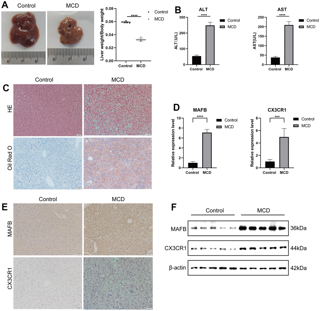 Validation of optimal feature genes in mouse module. (A) Fresh Livers and liver-to-body weight ratio in control and MCD mice. (B) The serum ALT and AST levels on control and MCD mice. (C) HE staining and Oil Red O staining of liver sections from mice fed on control or MCD-diet. (D) The relative expressions of MAFB and CX3CR1 were validated by RT-qPCR. (E) MAFB and CX3CR1 expression in liver tissues of control and MCD mice was detected by IHC. (F) MAFB and CX3CR1 expression in liver tissues of control and MCD mice was detected by WB. ***P 