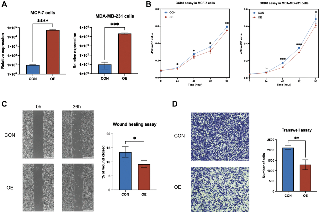 In vitro experiments to investigate the role of AL133467.1 in breast cancer cells. (A) qRT-PCR results showing the overexpression of AL133467.1 in MCF-7 and MDA-MB-231 cells. (B) CCK-8 assay results of MCF-7 and MDA-MB-231 cell proliferation. (C) Wound-healing assay results evaluating MCF-7 cell migration. (D) Transwell assay results of MDA-MB-231 cell migration. Statistical significance symbols: ns, p ≥ 0.05; *p **p ***p 
