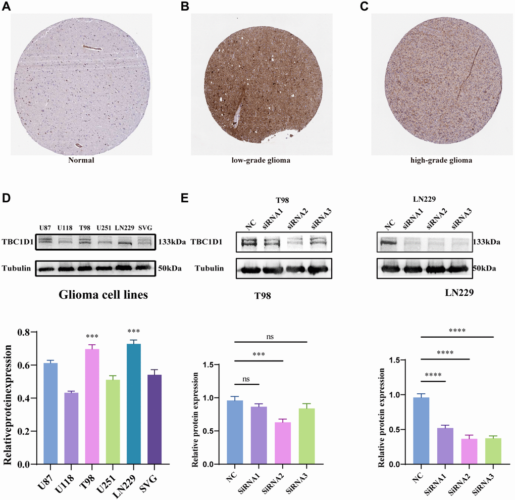 Immunohistochemistry results obtained from the HPA project database, expression of TBC1D1 across tissues and expression of TBC1D1 in glioma cell lines. (A) Protein expression of TBC1D1 in normal brain tissues. (B) Expression of TBC1D1 in low-grade glioma tissues. (C) Expression of TBC1D1 in high-grade glioma tissues. (D) Protein expression of TBC1D1 in glioma cell lines. (E) Knockdown of TBC1D1 by siRNA in T98 and LN229. (All data were presented as mean ± s.d. from three independent experiments (*P **P ***P ****P 