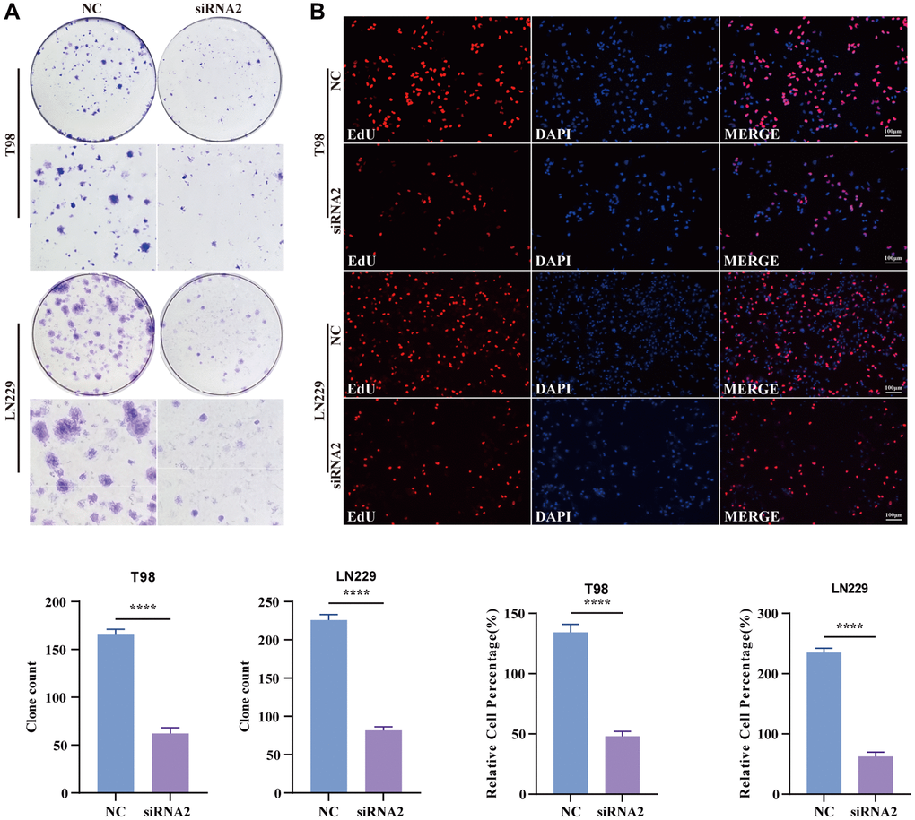 Knockdown TBC1D1 inhibits the proliferation of glioma cells. (A) Detection of proliferation of transfected cells by colony formation experiments. (B) Detection of proliferation of transfected cells by EdU staining (Scale bar = 100 μm). (All data were presented as mean ± s.d. from three independent experiments (*P **P ***P ****P 