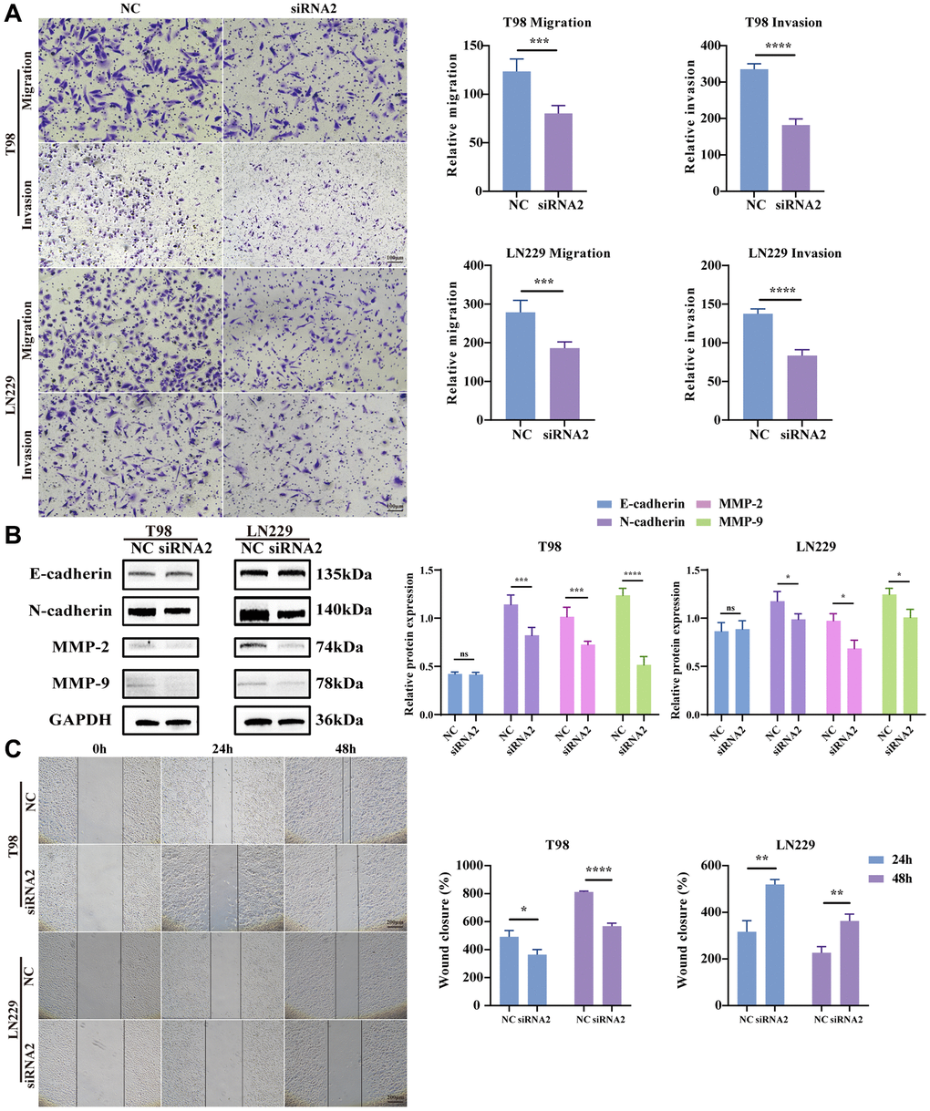 Knockdown TBC1D1 inhibits glioma cell migration and invasion. (A) Detection of migration and invasion of transfected cells by transwell method (Scale bar = 100 μm). (B) Detection of E-cadherin, N-cadherin, MMP-2 and MMP-9 protein expression. (C) Perform wound-healing assay to detect migration of transfected cells (Scale bar = 200 μm). (All data were presented as mean ± s.d. from three independent experiments (*P **P ***P ****P 