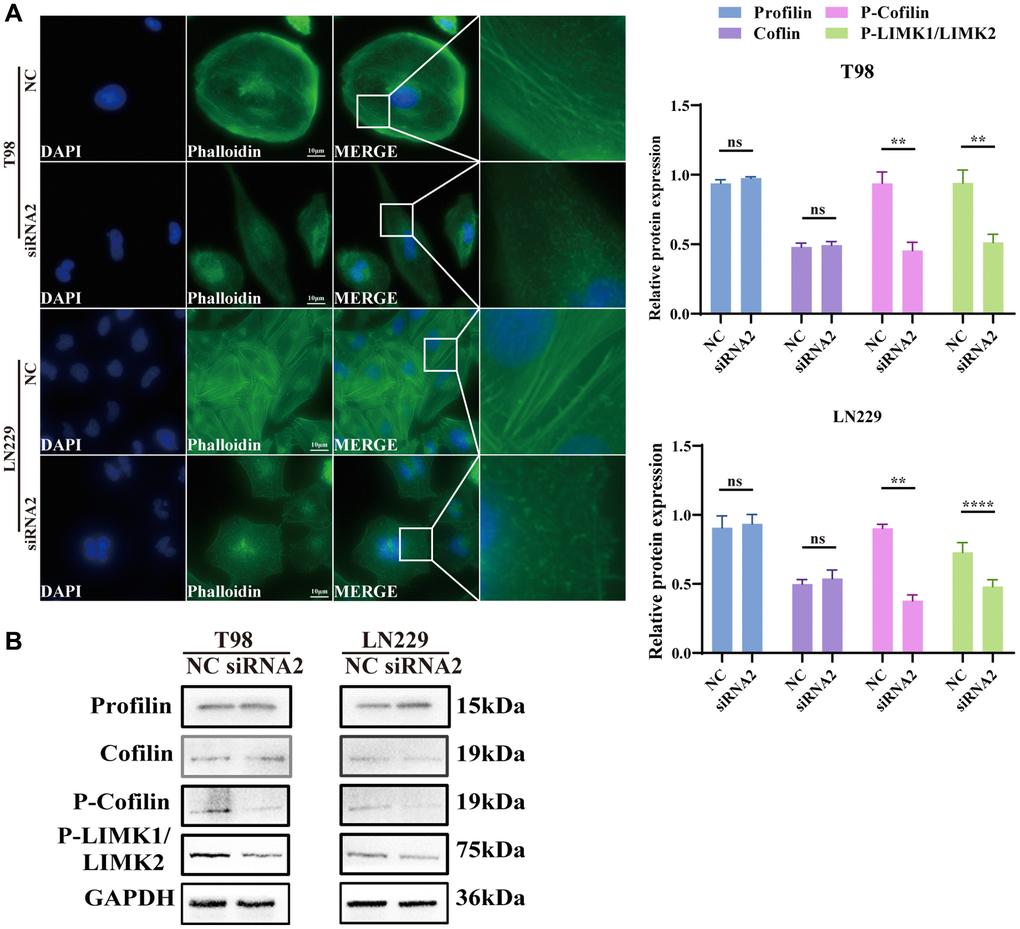 Knockdown TBC1D1 affects the integrity of the F-actin. (A) Fluorescence microscopy was used to observe the morphological changes of F-actin cytoskeleton stained with phalloidin after transfection (Scale bar = 10 μm). (B) Detection of profilin, cofilin, P-LIMK1Thr508/P-LIMK2Thr505 and P-cofilinSer3 protein expression. (All data were presented as mean ± s.d. from three independent experiments (*P **P ***P ****P 