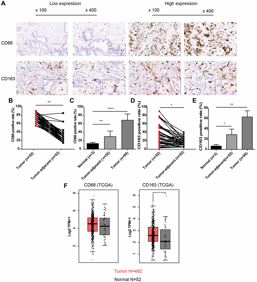 Expression patterns of CD68 and CD163 proteins in PCa and normal prostate tissue. (A) Representative IHC images of PCa tissue slides with low (left panel) or high (right panel) levels of CD68 and CD163 protein. IHC, immunocytochemistry. (B) Dot plot shows the positive rate of CD68 in PCa and para-cancer (para-PCa) tissue. (C) Bar plot shows the positive rate of CD68 in normal prostate tissue, para-PCa, and PCa. (D) Dot plot shows the positive rate of CD163 in PCa and para-PCa tissue. (E) Bar plot shows the positive rate of CD163 in normal prostate tissue, para-PCa, and PCa. (F) Box plots showed the mRNA expression levels of CD68 and CD163 in the TCGA-PRAD dataset. Student’s t-test, *P **P ****P 