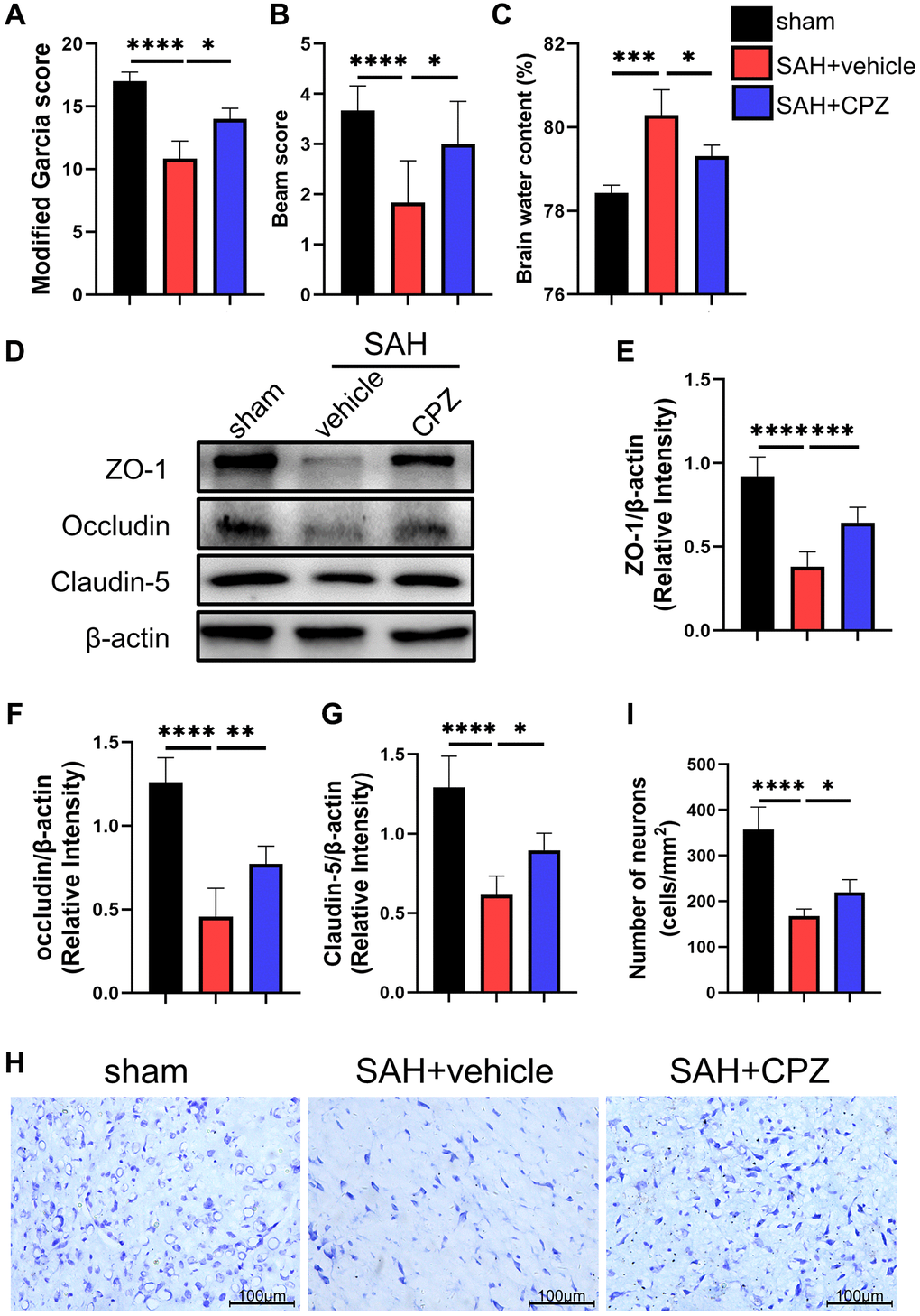 Effect of TRPV1 on neurological function, brain edema, and neuron injury. (A, B) Neurological function at 24 h post-SAH was evaluated via modified Garcia and beam score. (C) The water content of the left hemisphere at 24 h post-SAH. (D–G) The relative protein expression of ZO-1, Occludin, and Claudin-5 at 24 h post-SAH was assessed via western blot. (H, I) The neuron number at 24 h post-SAH was assessed via Nissl stain. *p **p ***p ****p 