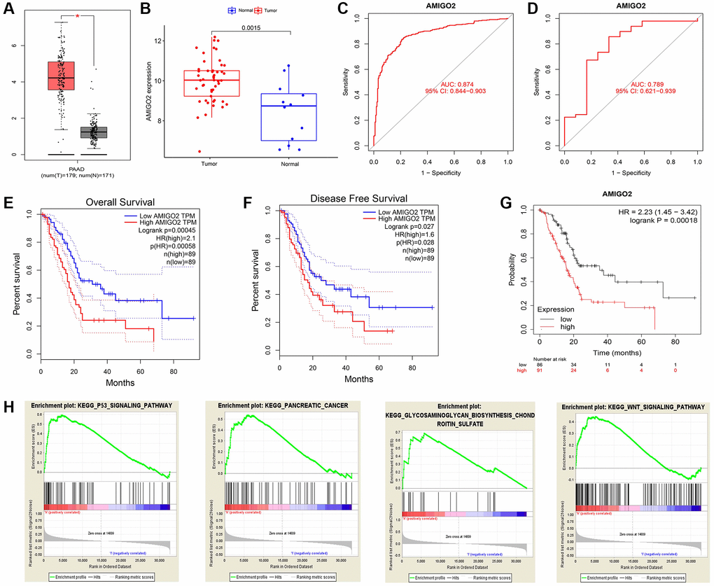 (A) The expression of AMIGO2 between normal samples and tumor samples of PDAC patients in TCGA datasets. (B) The expression of AMIGO2 between normal samples and tumor samples of PDAC patients in GSE60980 (Validation group). (C) The ROC curve of AMIGO2 in the combined GEO datasets group above. (D) The ROC curve of AMIGO2 in GSE60980 (Validation group). (E) Overall survival of PDAC patients with different expression of AMIGO2 in GEPIA. (F) Disease free survival of PDAC patients with different expression of AMIGO2 in GEPIA. (G) Overall survival of PDAC patients with different expression of AMIGO2 in KM plotter. (H) The GSEA results comparing AMIGO2-high group to AMIGO2-low group.