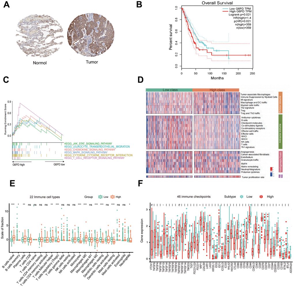 G6PD expression, prognostic value, and enriched pathways in LUAD tissues. (A) IHC staining of G6PD in normal and LUAD tissues from the HPA database. (B) The prognostic analysis of G6PD in LUAD patients. (C) GSEA of the enriched pathways in LUAD patients with high G6PD expression (D) The enriched immune-related pathways in LUAD patients by ssGSEA. (E) The level of immune cell infiltration of 22 subpopulations of immune cells in the G6PD high and low groups based on the CIBERSORT algorithm. (F) The levels of immune checkpoint molecules in the G6PD high and low groups.