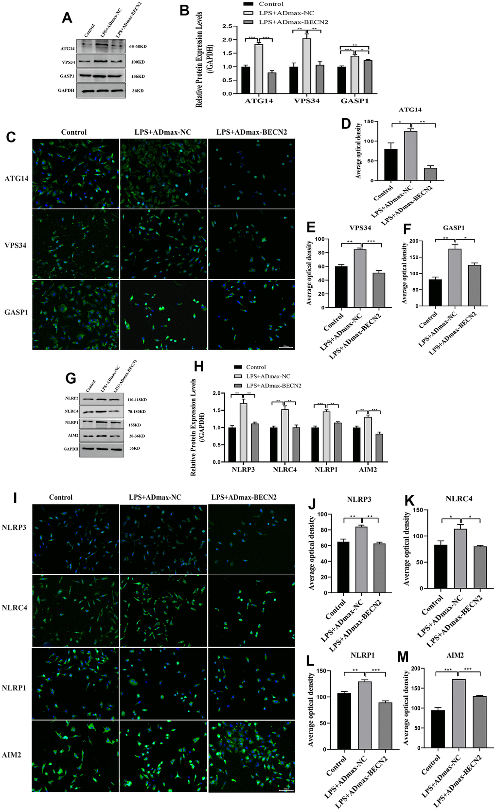 Increased BECN2 attenuated the autophagy and inflammation of LPS-induced ATDC5 degeneration. (A) Western blot was employed to detect the expression of ATG14, VPS34 and GASP1. (B) The protein expression of ATG14, VPS34 and GASP1 were determined using ImageJ software, GAPDH was used as the internal control, respectively (n=3). (C) ATG14, VPS34 and GASP1 expression were determined by immunofluorescence staining (scale bar: 100μm). (D–F) Average optical density was calculated by ImageJ software. (G) Western blot was employed to detect the expression of NLRP3, NLRC4, NLRP1 and AIM2. (H) The protein expression of NLRP3, NLRC4, NLRP1 and AIM2 were determined using ImageJ software, GAPDH was used as the internal control, respectively (n=3). (I) NLRP3, NLRC4, NLRP1 and AIM2 expression were determined by immunofluorescence staining (scale bar: 100μm). (J–M) Average optical density was calculated by ImageJ software. All data represent mean ± SD. All in vitro experiments were repeated three times independently. * p p p 